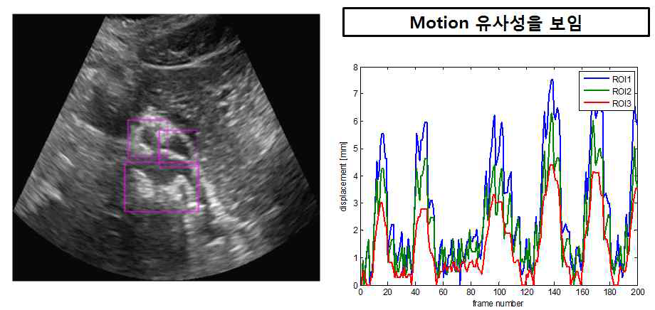 Multiple ROI인 경우, Global한 Motion이 유사하므로 Motion vector 측정 결과 또한 모두 유사할 것이다.