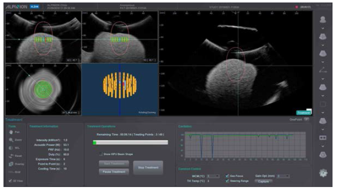 Cavitation Graph