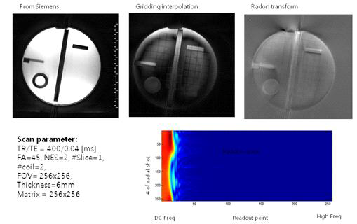 UTE 영상 재구성 및 팬텀을 통한 영상 구성 알고리즘 비교 (상단) 영상 Raw 데이터의 sinogram (하단)