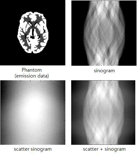 뇌 모양 팬텀 단일 산란 시뮬레이션 결과