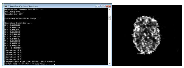 OS-EM을 통한 영상 재구성 과정(좌) 및 최종 재구성 영상(우)
