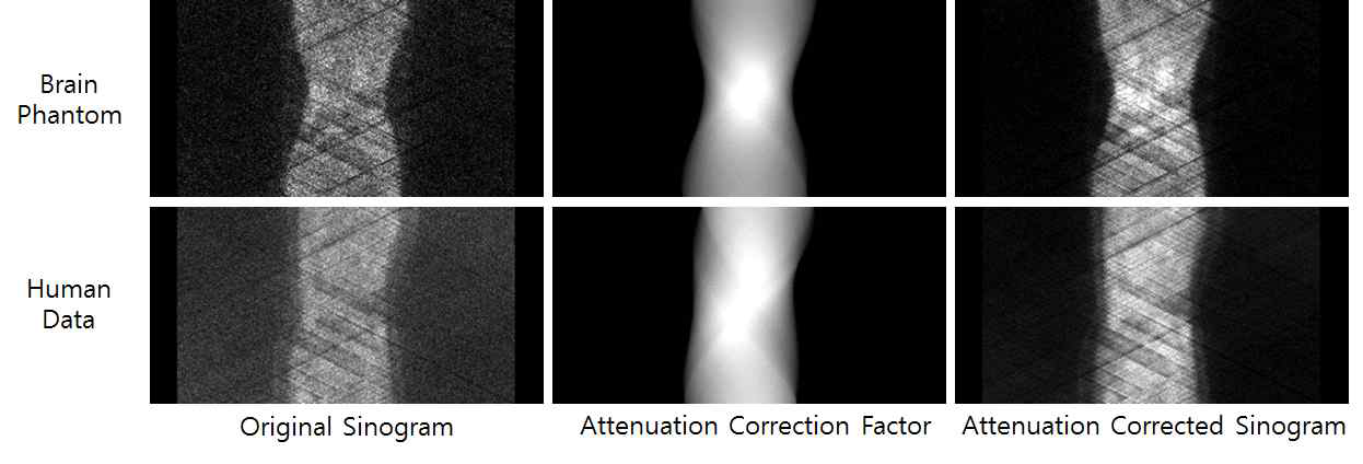 개발된 PET/MR 장비를 통해 취득한 사이노그램영상과 감쇠보정계수, 보정된 사이노그램