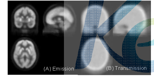 SNU 데이터로 만든 방출 PET(A) 과 투과 PET의 표준판(B)