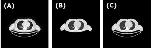 (A) CT 원영상, (B) 네 영역(폐, 뼈, 연부조직, 인체 외 백그라운드) 분할 영상. (C) 네 영역에 환자 베드를 추가한 네 영역 + 베드 분할 영상