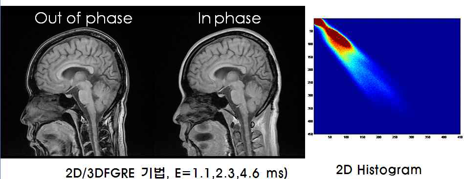 뇌의 Dual echo 영상 (in or out-of phase)과 두 영상의 영상신호크기에 대한 2D histogram