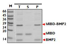 hRBD - 6xhis - tev site(Gx) - BMP2의 protease cleavage후 solubility test