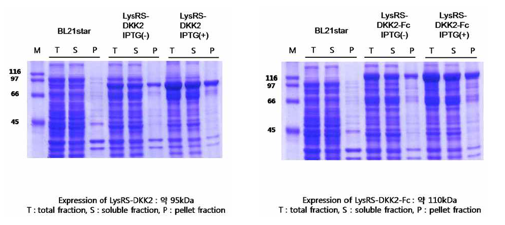 LysRS - DKK2 (Kan+) 또는 LysRS - DKK2-Fc (Kan+) 단백질 발현