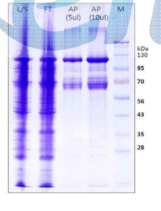 LysRS-DKK2Fc 재조합단백질의 ProteinA 정제시료 SDS-PAGE 분석.