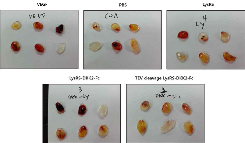 Matrigel plug assay 결과