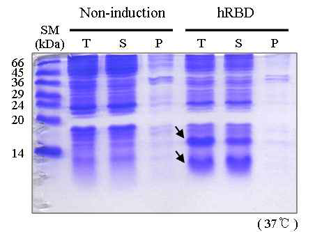 hRBD expression and verification of its solubility