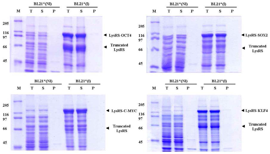 Expression of Four transcription factor for inducing iPS cells