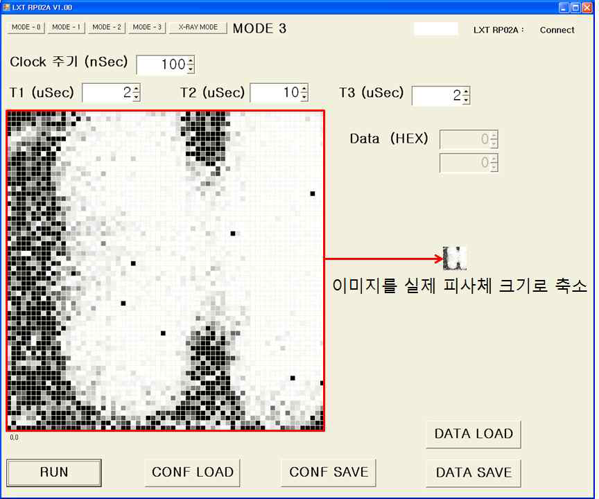 X선 촬영 피사체 Image