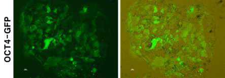 OCT4 reporter system 도입 인간배아줄기세포주