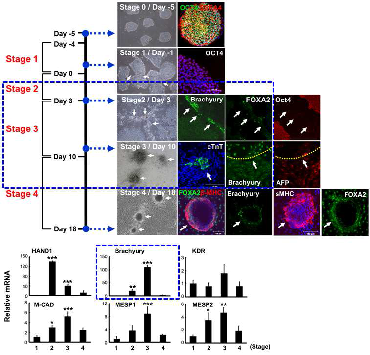 인간배아줄기세포유래 중배엽 세포분화 단계별 Brachyury 발현양상 분석
