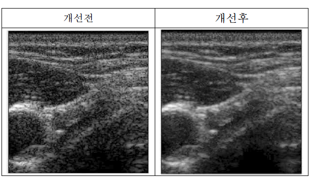 BC Mode 이질감 개선