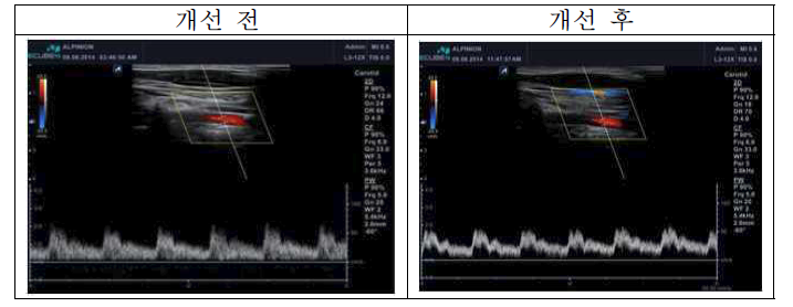 Spectrum 감도 개선