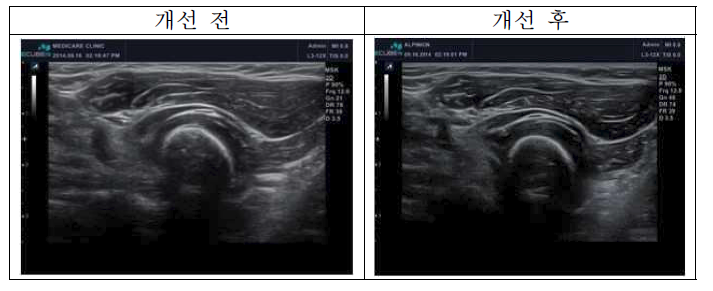 근골격계 해상도