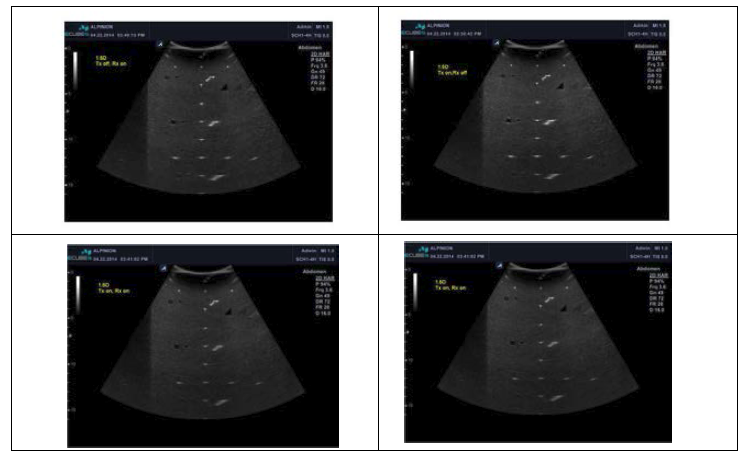 1.5D Tx, Rx On Off 이미지 결과