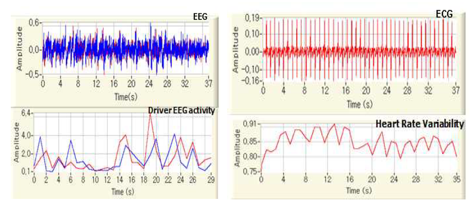 EEG 신호 분석 및 ECG 신호 분석