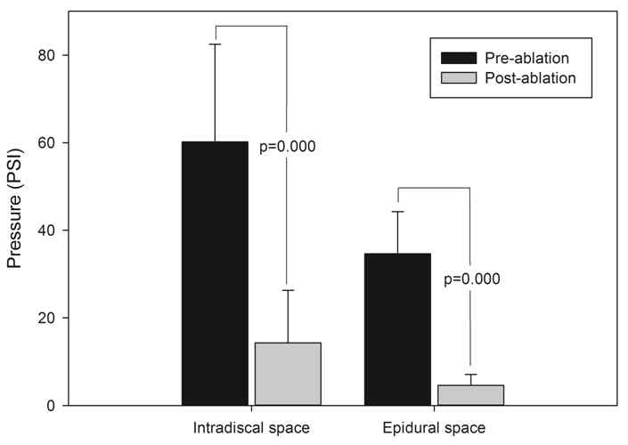 레이저 조사 전과 후에 Intradiscal space와 epidural space에서 측정됩 압력.