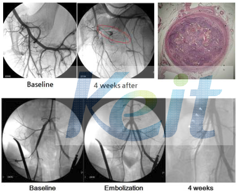 생성된 돼지 하지동맥 CTO X-ray 영상과 조직 모습: 대퇴동맥(상), 장골동맥(하)