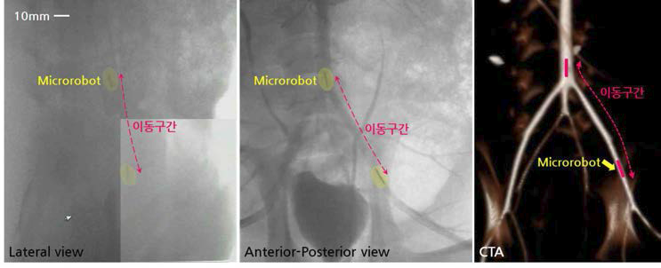 In-vivo에서 Microrobot 이동 장면