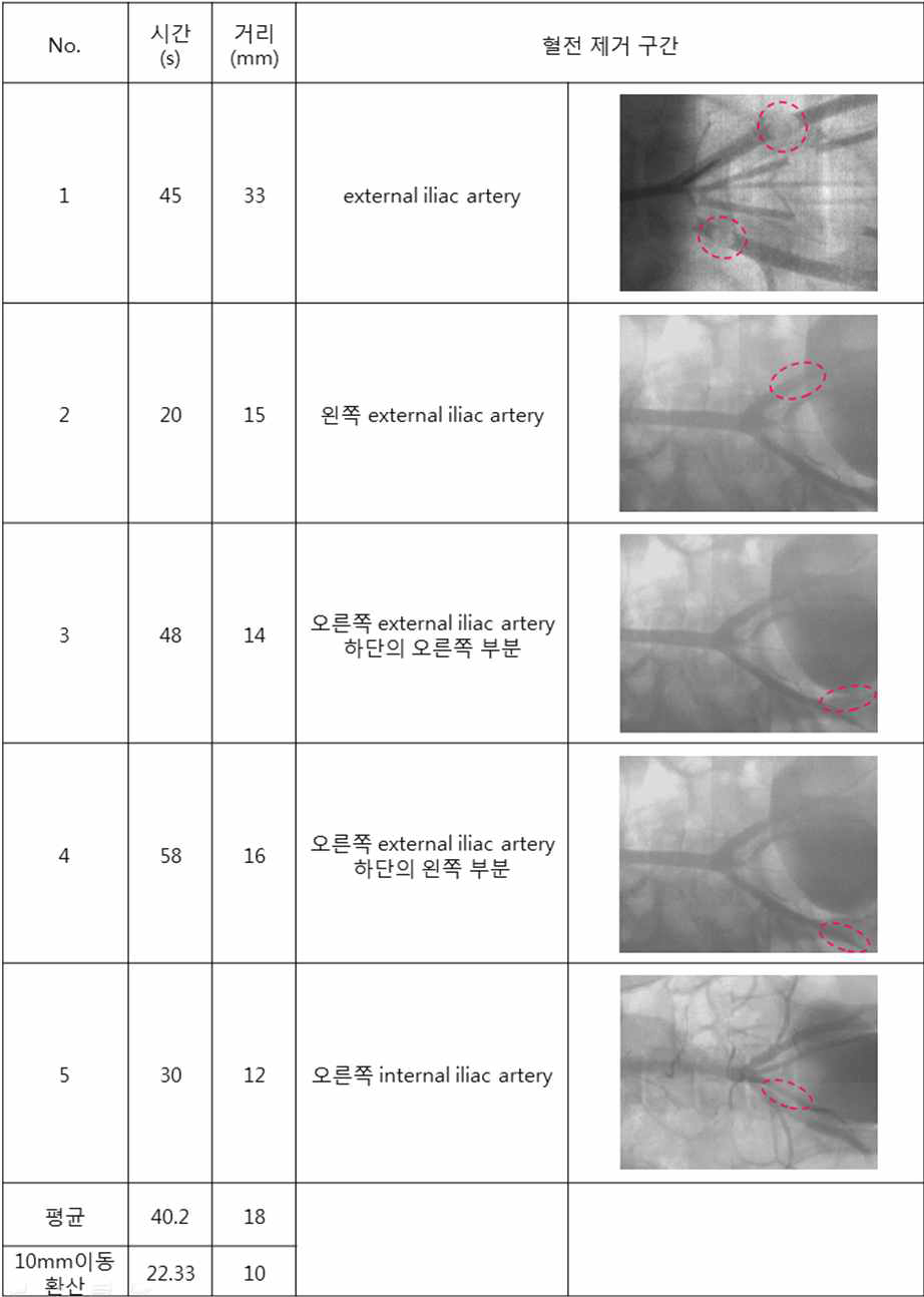 In-vivo 실험에서의 혈전 관통 실험 결과