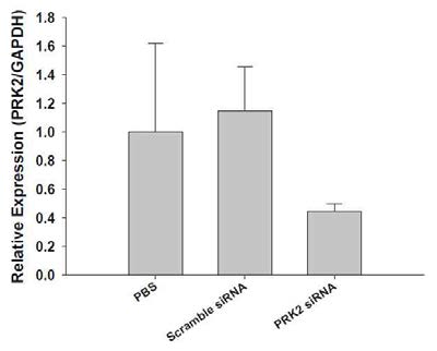 리피도이드(ND98)를 이용하여 소동물 모델 (쥐)의 간 조직으로 PRK2 siRNA를 전달한 후 측정된 PRK2 발현양 비교