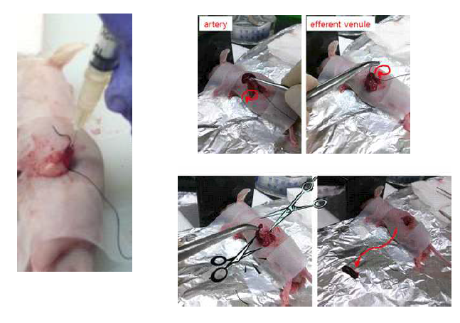 감암세포가 주입 후 splenectomy로 spleen를 절제하는 수술 과정.