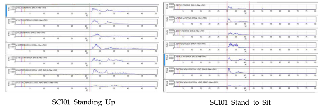 앉기-서기 동작에서의 강직감지 실험결과_SCI01