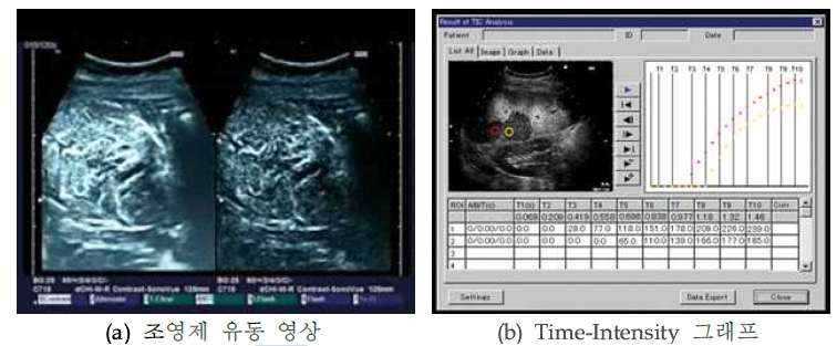 기존 조영제 유동 추적 기법의 조영제 유동 분석