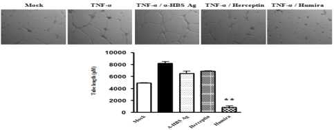 Humira® 처리에 의해 저해된 혈관내피세포 튜브형성