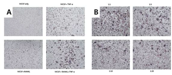 (A) TNF-α가 주도하는 파골세포 분화조건 확립 (B) Humira® 처리에 의해 감소된 파골세포 분화