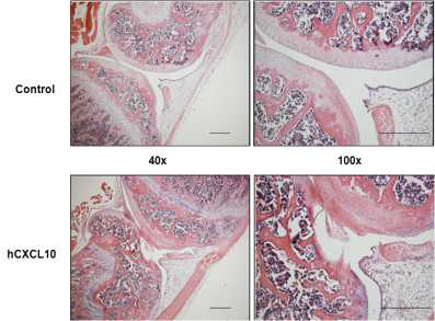 관절강 내 hCXCL10 직접 주입 14일 후: H&E stain 결과