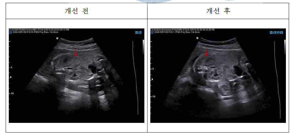 영상 화질 개선