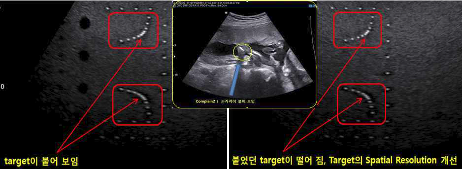 Bone 구조물의 번짐, 붙어 보이는 현상 개선