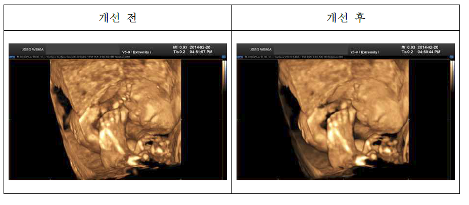 3D 영상 개선