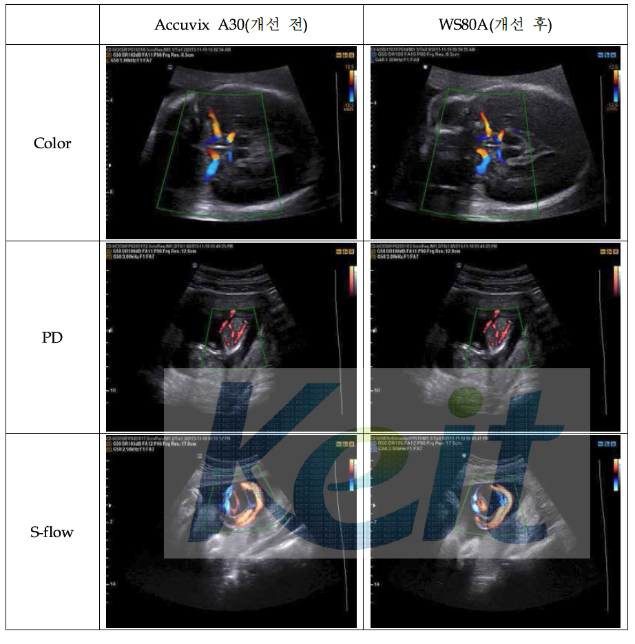 개선 전․후 장비의 CD / PD / S-flow mode 영상 비교