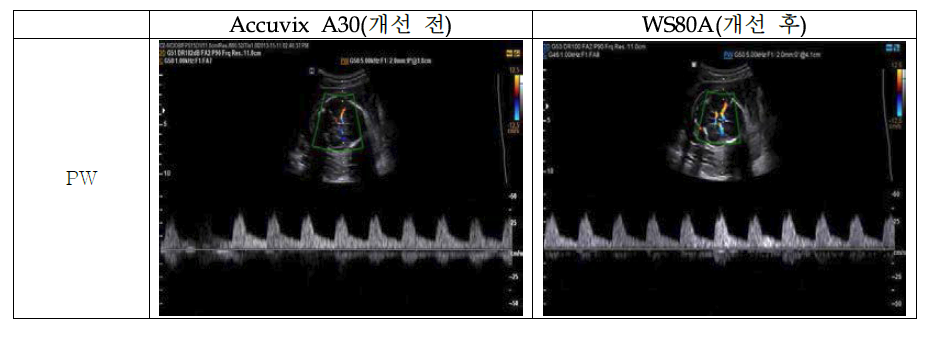 개선 전․후 장비의 PW 영상 비교