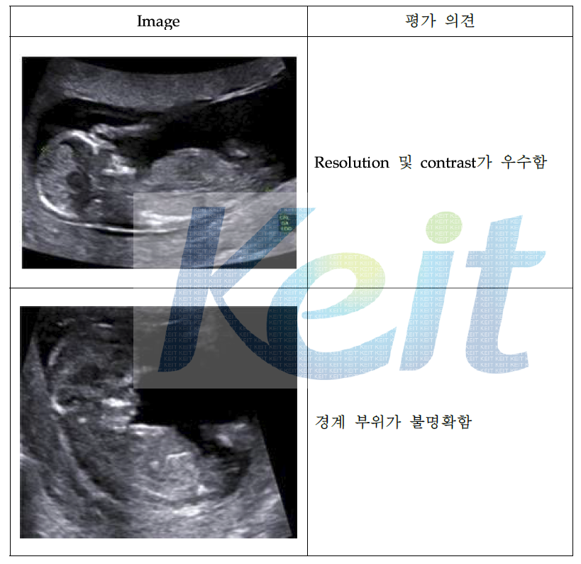 1st Trimester 피험자 평가 영상