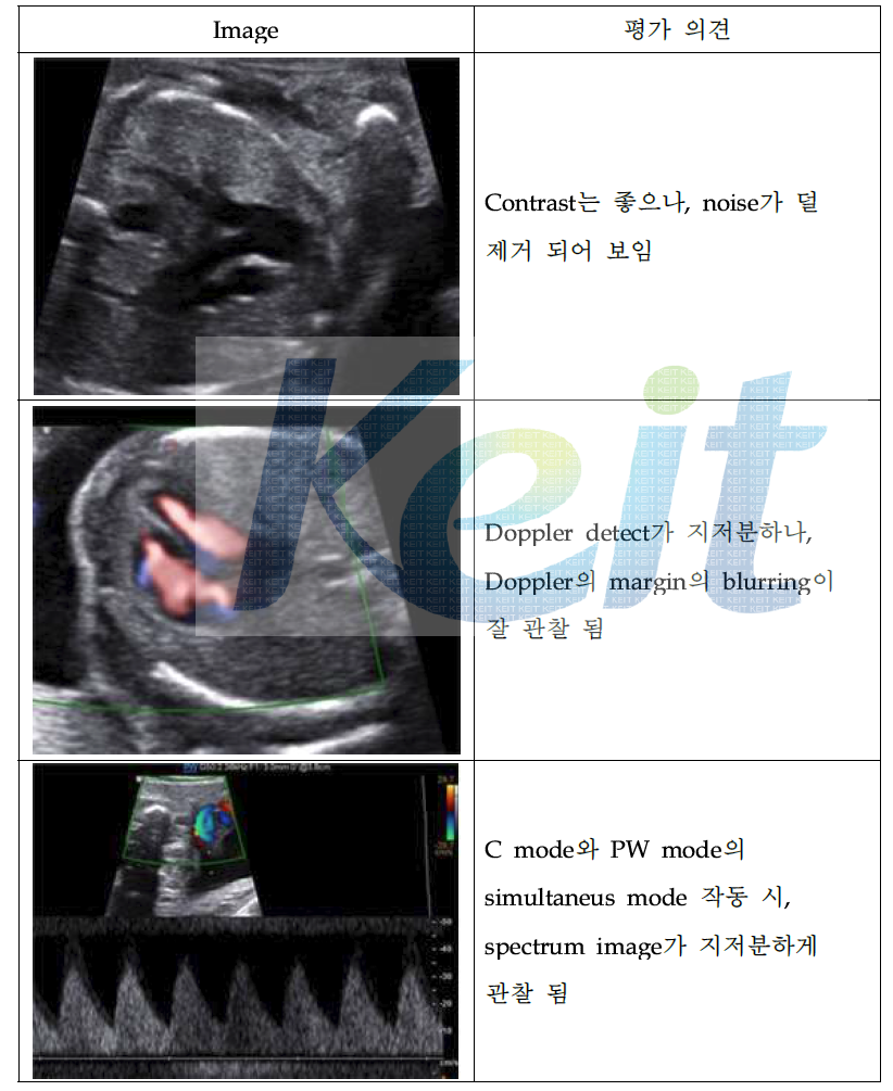 2nd Trimester 피험자 평가 영상