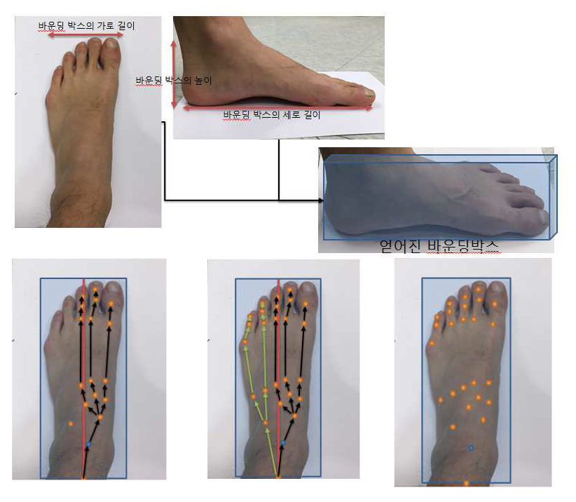 발 뼈대 추출 기법의 설명