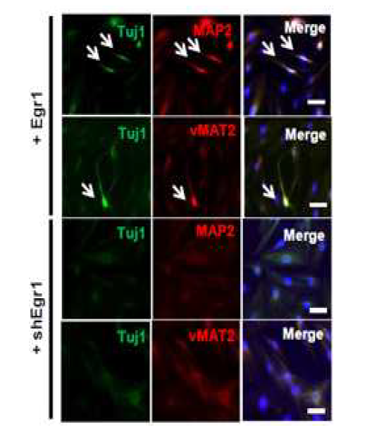 Egr1 발현조절에 따른 전자기장 유도 신경분화에서의 신경 특이적 유전자 면역염색.