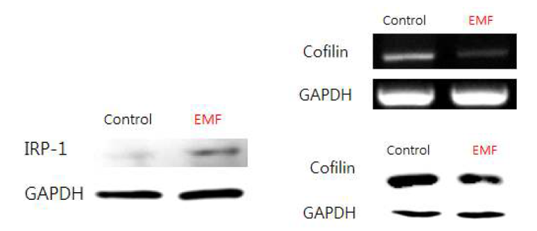 Ferritin 관련 인자 Iron Regulatory Protein1(IRP1)과 Cofilin의 발현