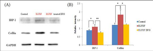 Deferoxamine을 hMSC에 처리한 후 Ferritin 관련 인자 Iron Regulatory Protein1(IRP1)과 Cofilin의 발현