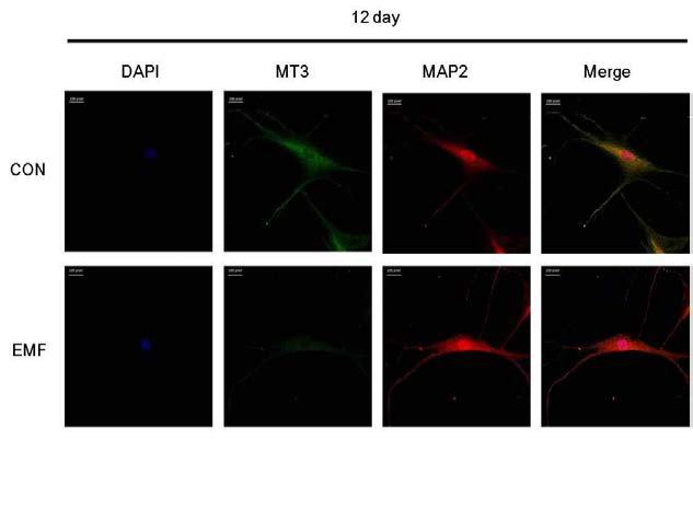 전자기장 노출시 IF staining을 통한 BM-hMSCs Intracellular MT3 및 MAP2 단백질의 변화