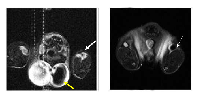 NIR-코어 실리카 나노입자의 림프절 MRI 조형 효과