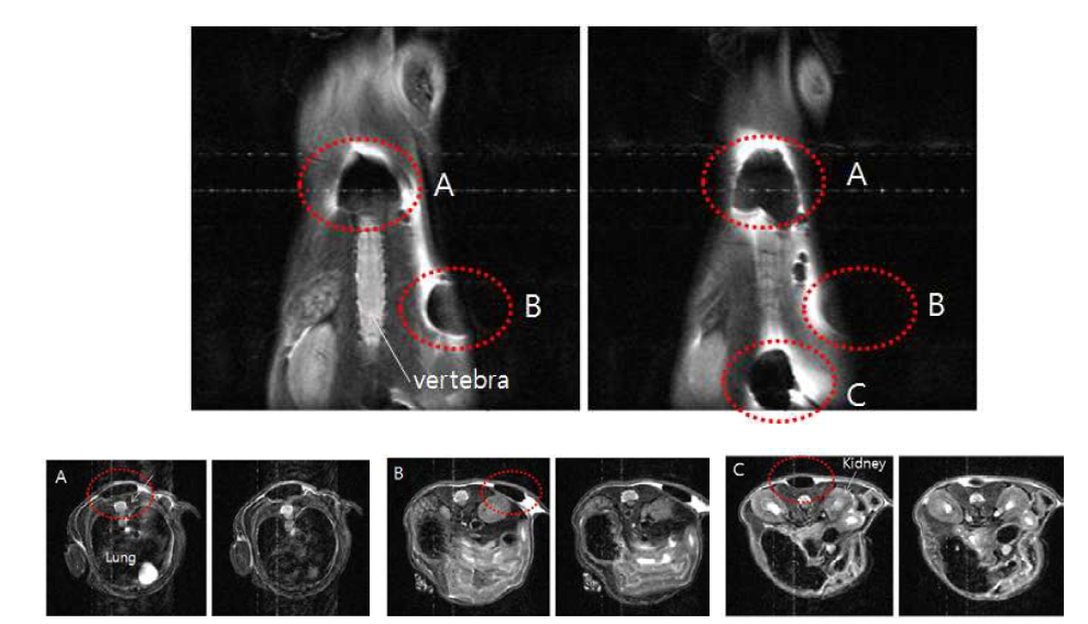 A549 세포에 uptake 된 NIR-코어 실리카 나노입자의 MRI 조형 효과