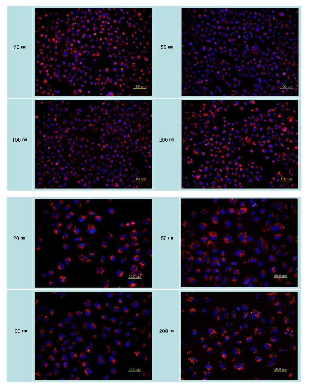 입자의 크기별 RITC-실리카 나노입자의 세포탐식 결과