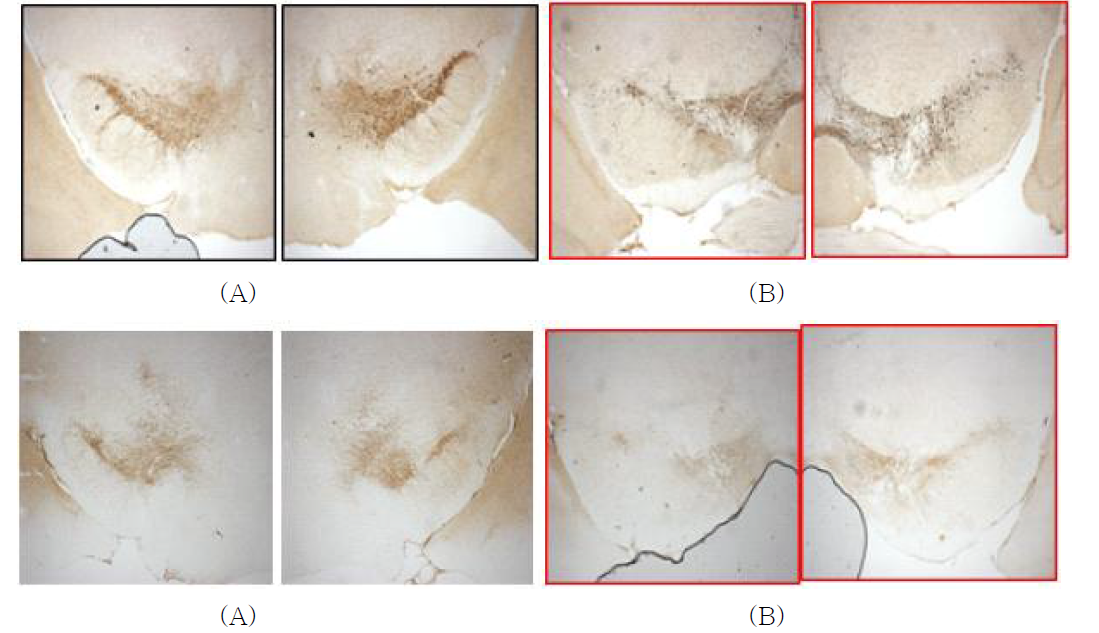 14 개월령 hLRRK2 G2019S transgenic mouse (A)와 non-transgenic (B) 마우스 흑질 부위 tyrosine hydroxylase (위)와 dopamine transporter (아래) 의 면역조직염색